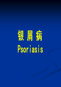 银屑病