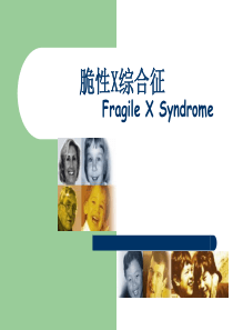 脆性X综合征