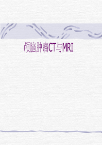 颅脑肿瘤CT与MRI