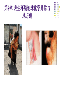 第九章--表生环境化学与人体健康