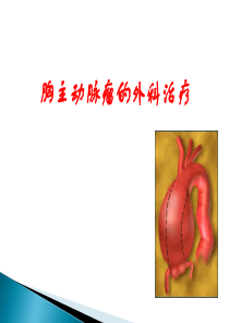 胸主动脉瘤的外科治疗