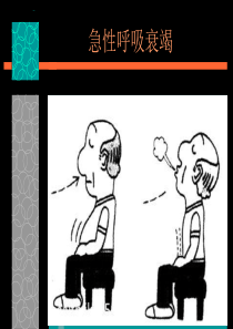 急性呼吸衰竭.ppt