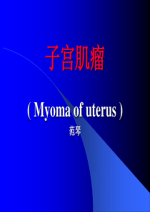 子宫肌瘤