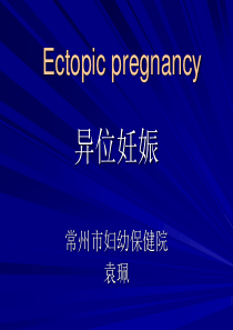 异位妊娠(课件)