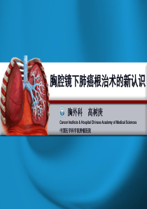 胸腔镜下肺癌根治术的新认识