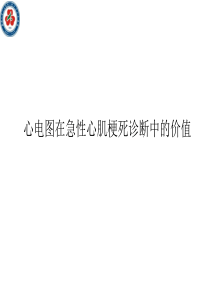 EKG在心肌梗死诊断中的价值
