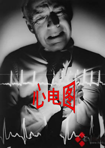 心电图的相关知识