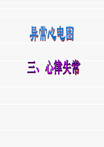 3、-异常心电图图谱汇总[10]