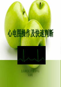 心电图操作及快速判断