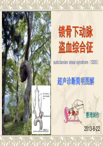 锁骨下动脉盗血综合症图解