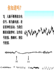 生物：2.2《神经系统的结构和功能》课件(浙科版必修三)