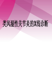 类风湿性关节炎的x线诊断-ppt课件