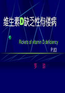 4维生素D缺乏性佝偻病