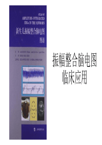 振幅整合脑电图