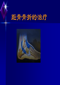 距骨骨折