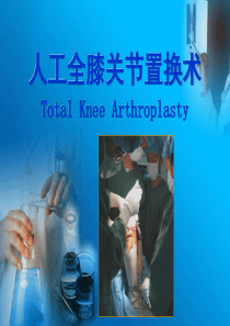 人工全膝关节置换术ppt课件