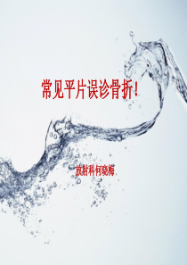 常见平片误诊骨折!