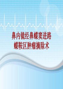 手术讲解模板：鼻内镜经鼻蝶窦进路蝶鞍区肿瘤摘除术