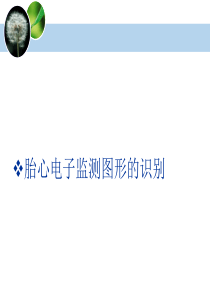 胎心监护课件