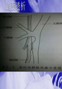 什么是血液透析