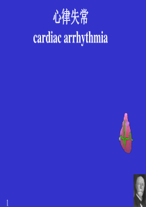 arrhythmia(心律失常)英文版