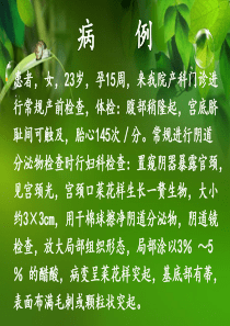 妊娠合并尖锐湿疣护理查房