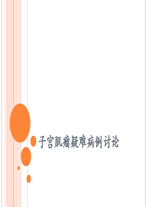子宫肌瘤疑难病例