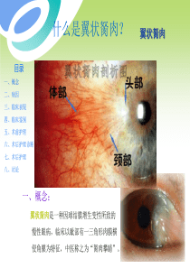 翼状胬肉护理介绍
