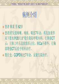 肺癌病例分析课件
