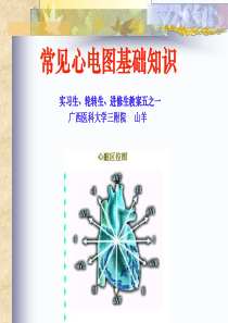 常见心电图诊断基础-教案之一[1]