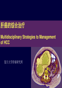 2019年肝癌综合治疗.ppt