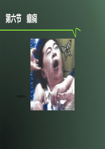癫痫