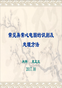 常见异常心电图的识别及处理方法