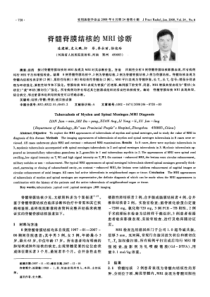 脊髓脊膜结核的mri诊断