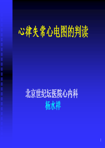 心律失常心电图(转)