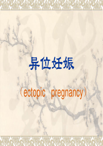 异位妊娠ppt课件