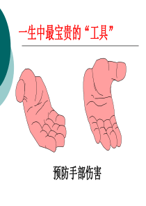 预防手部伤害