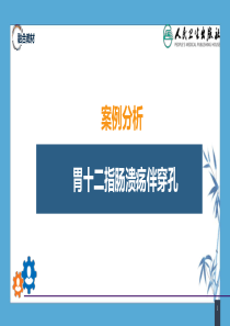 【人卫第九版普外科】第三十四章-胃十二指肠疾病-案例分析-胃十二指肠溃疡伴穿孔-(1)