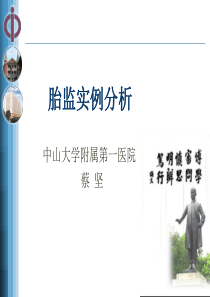 胎监实例分析讲解