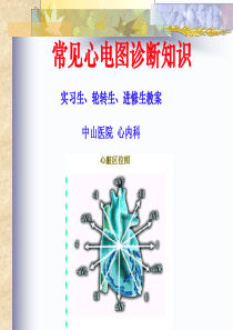 常见心电图诊断-PPT课件