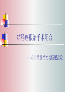 结肠癌根治手术