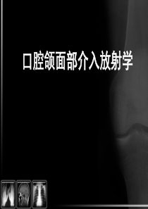 【医学课件】口腔颌面部介入放射学PPT