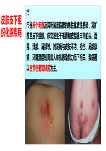 皮肤及皮下组织化脓性感染