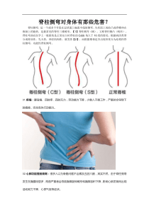 脊柱侧弯的危害