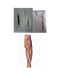 膝后部位疼痛---股二头肌