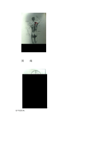 颈痛